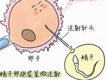 试管移植后头疼的原因有哪些？这种现象正常吗？